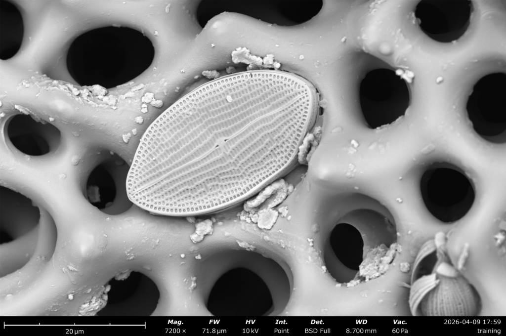 A slightly textured object embedded in a web-like structure.