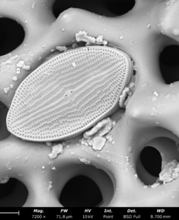 A slightly textured object embedded in a web-like structure.
