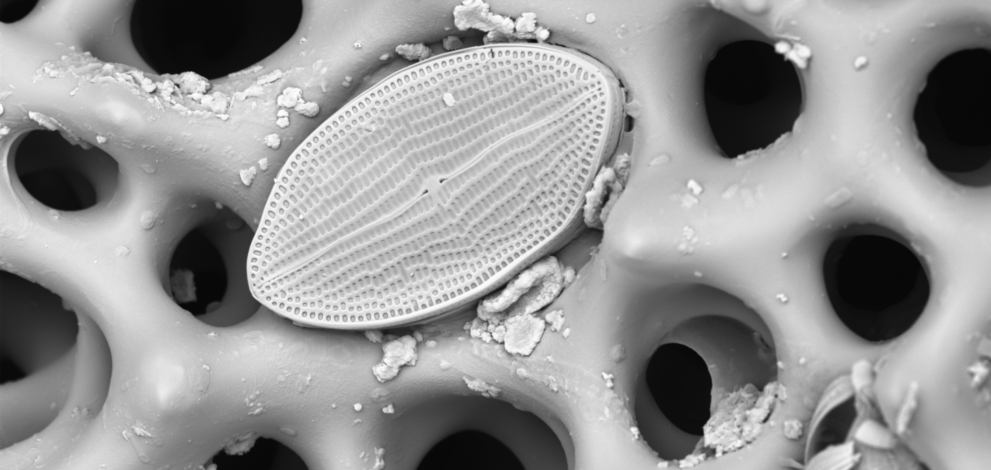 A slightly textured object embedded in a web-like structure.